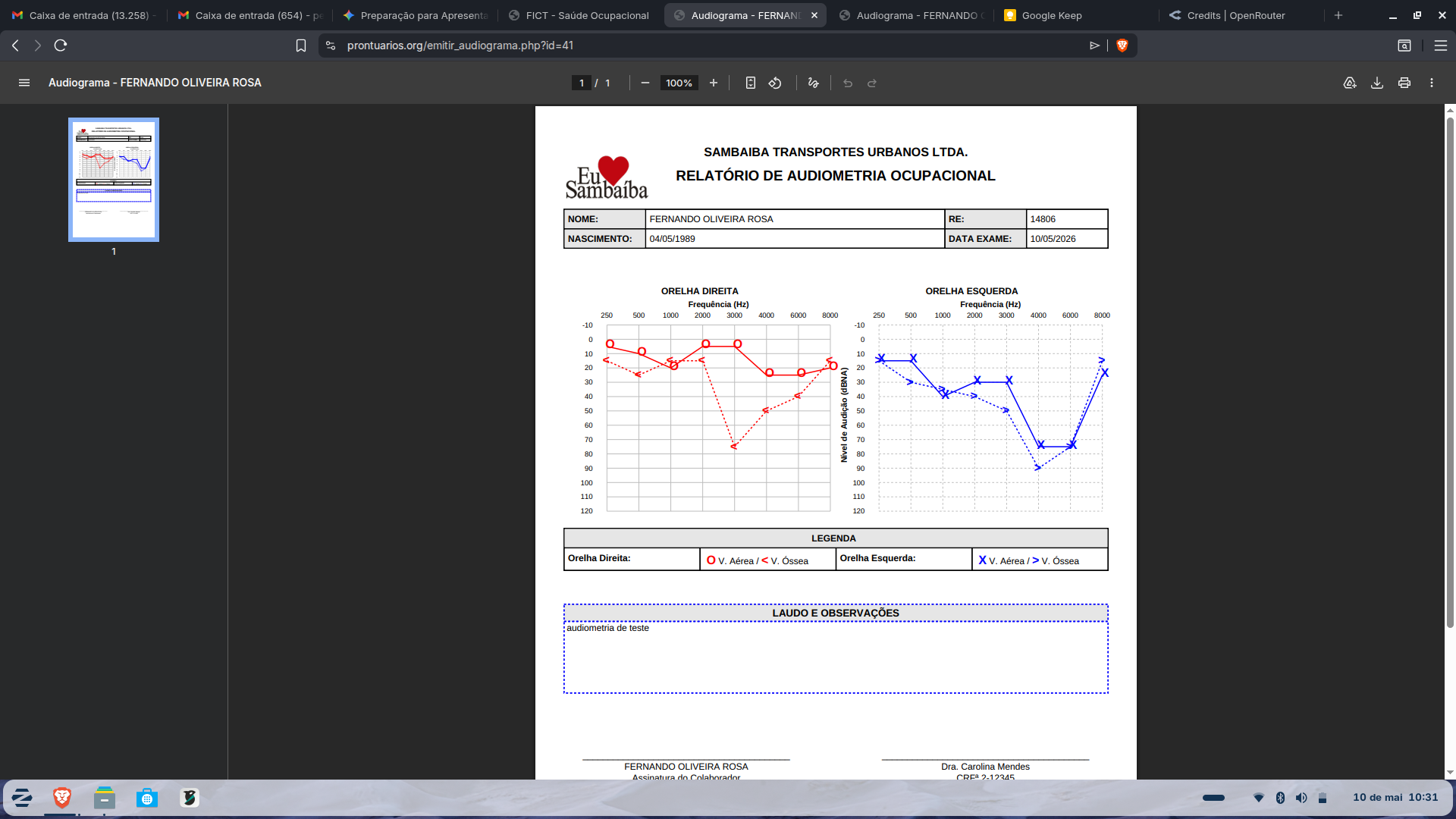 Laudo PDF Audiograma